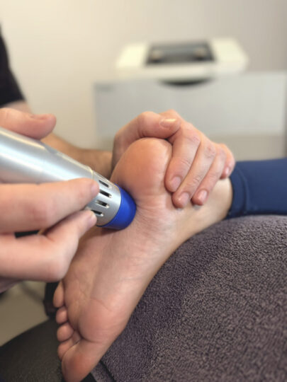 Radiale Stoßwelle wird zum Beispiel zur Therapie eines Fersensporns eingesetzt